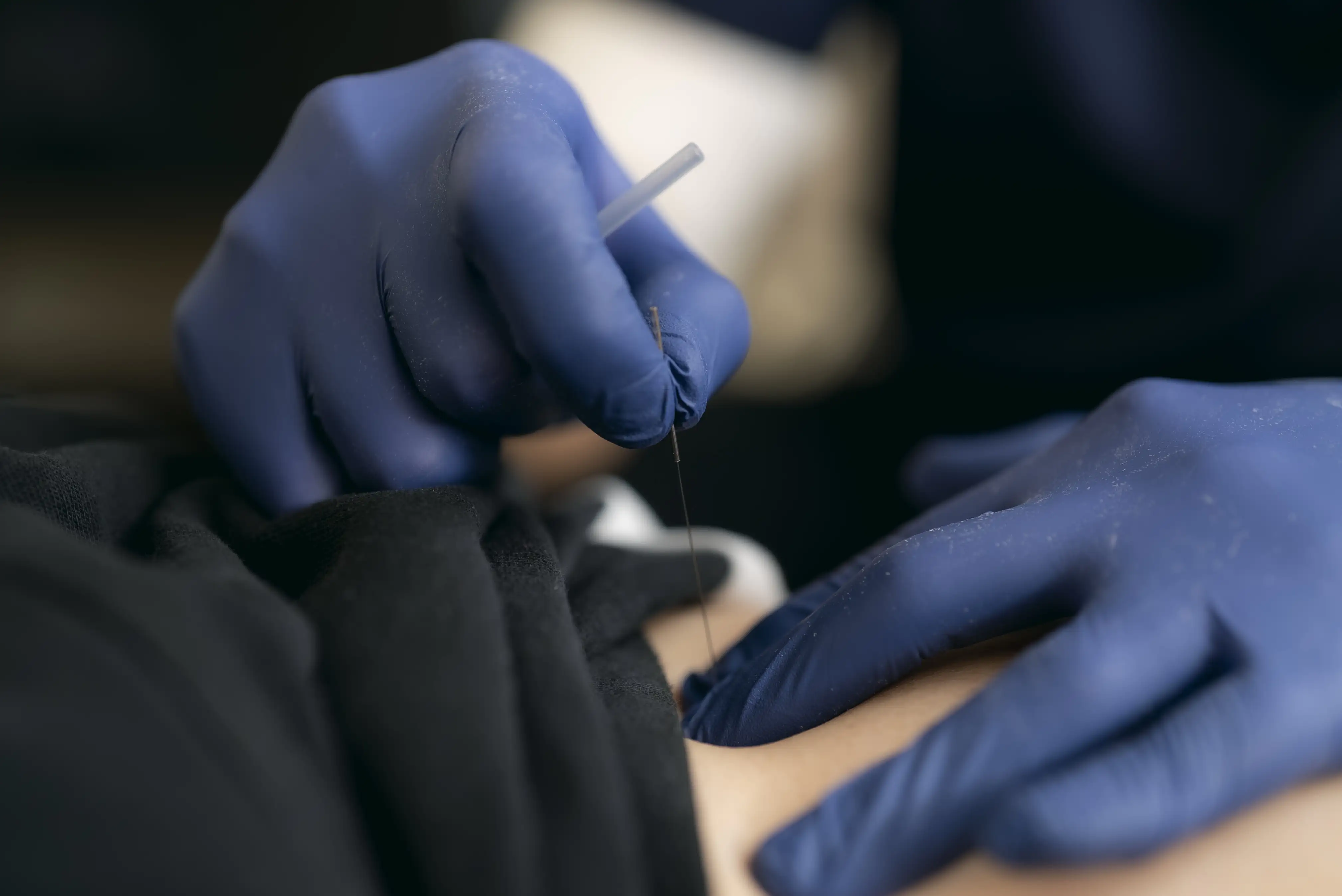 dry-needling-kl-ian-the-chiro